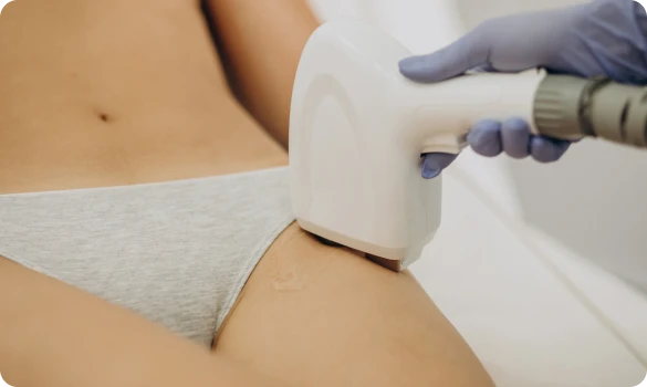 laser-epilation-hair-removal-therapy