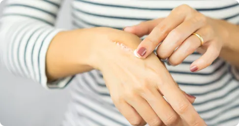 dermatologist_for_acne_scar_removal