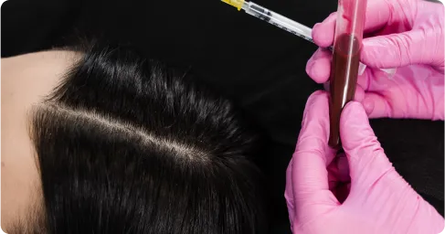 Cost_PRP_Hair_Treatment,